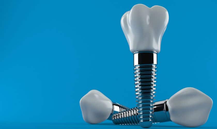Implant Dentist Tulsa