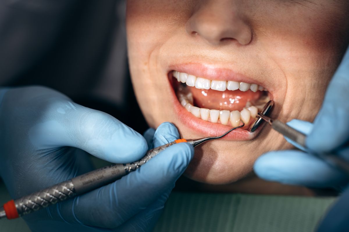 periodontal treatment
