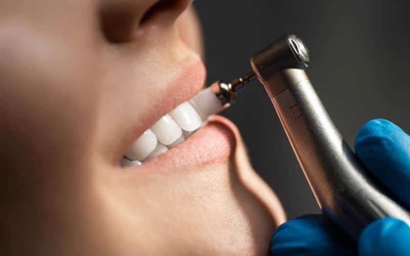 Teeth Cleaning in Tulsa Teeth Cleaning in Tulsa