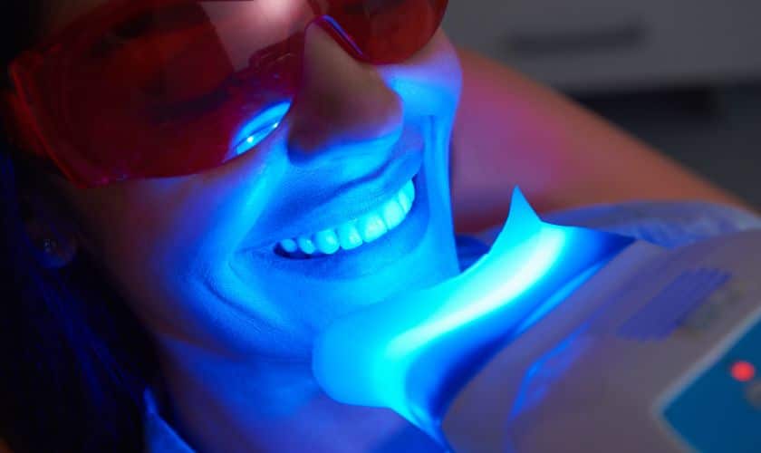 Unlocking Radiant Confidence: The Secrets Of Effective Teeth Whitening For A Dazzling Smile