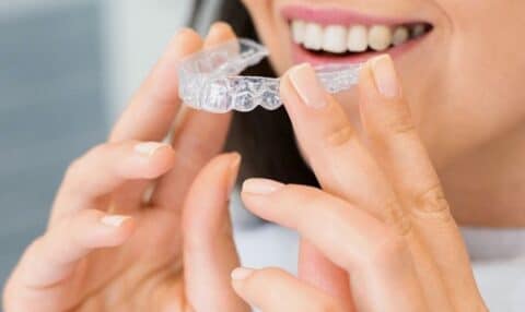 Step-by-Step Guide to Straightening Your Smile