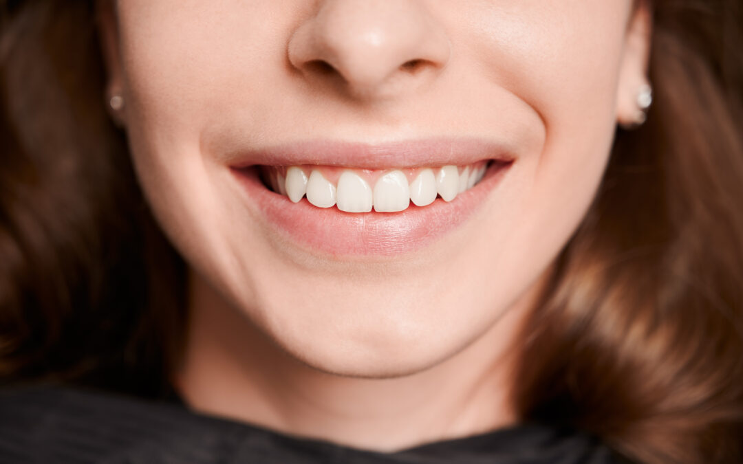 Enhance Your Smiles And Boost Confidence