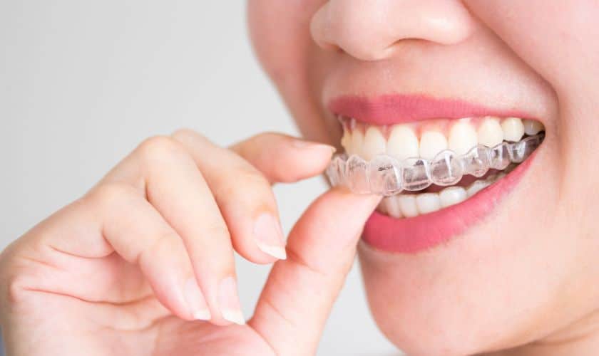 Invisalign Tulsa