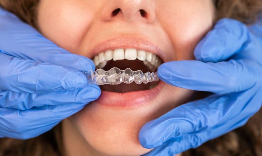 Invisalign in Tulsa