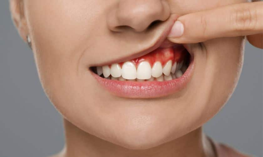 Gum Disease Tulsa