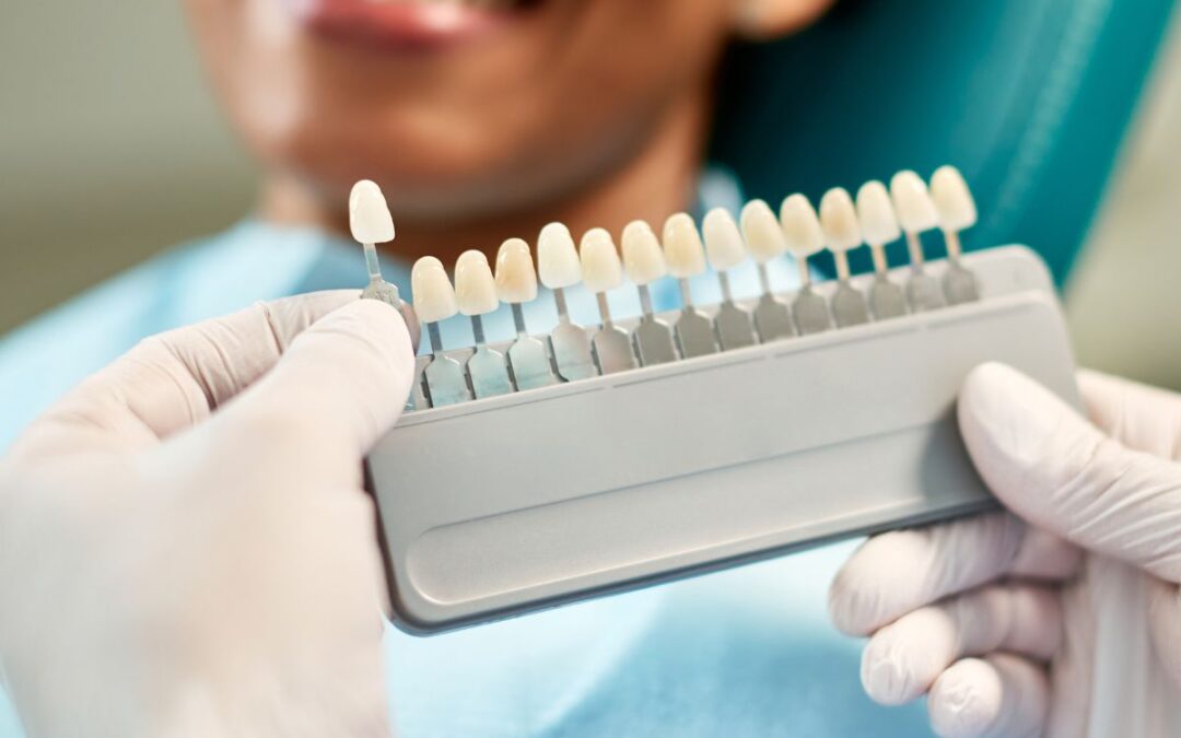 Can Dental Veneers Fix Crooked Teeth?