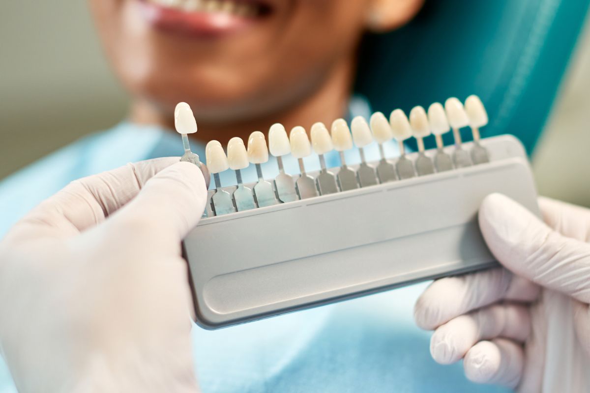 close up of dentist chooses right shade of implant close up of dentist chooses right shade of implant