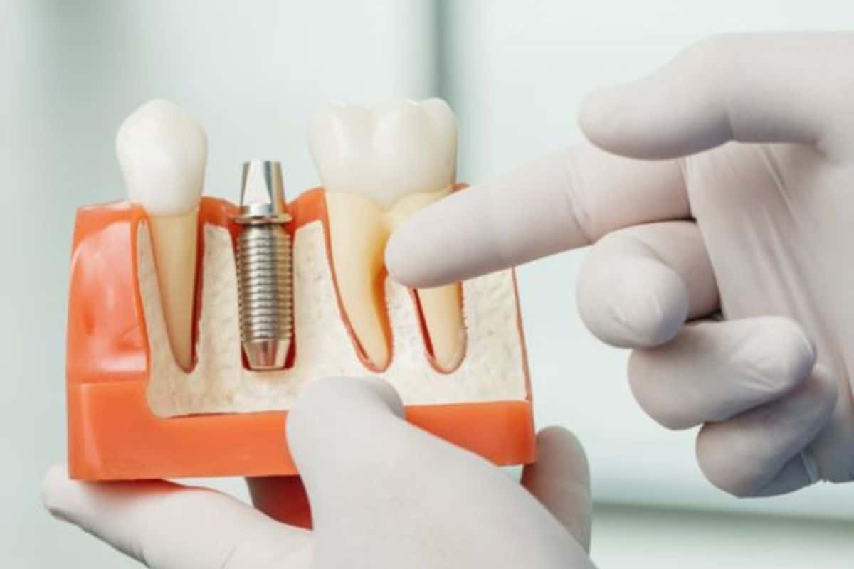 Dental Implants Tulsa Dental Implants Tulsa
