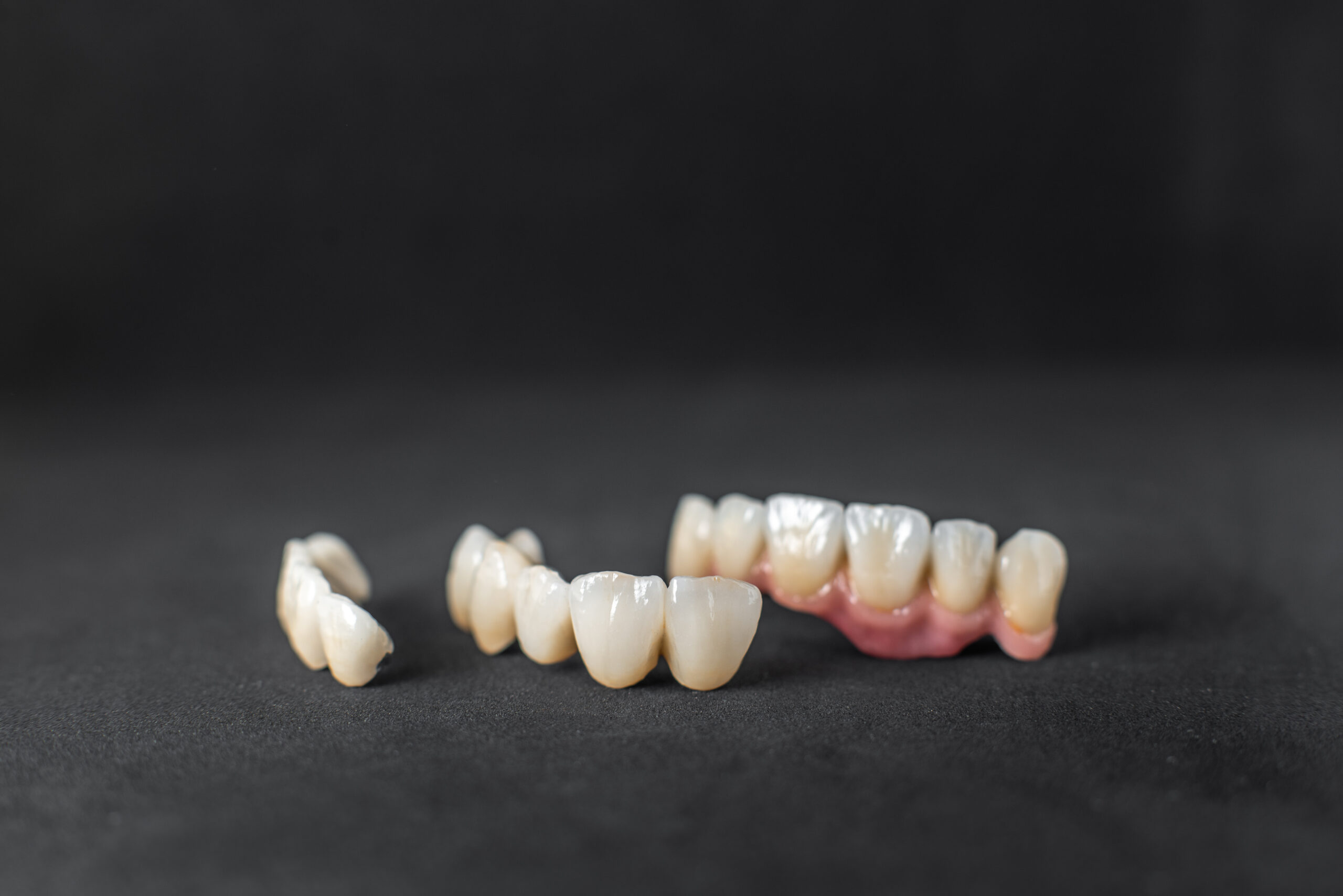 dental crown