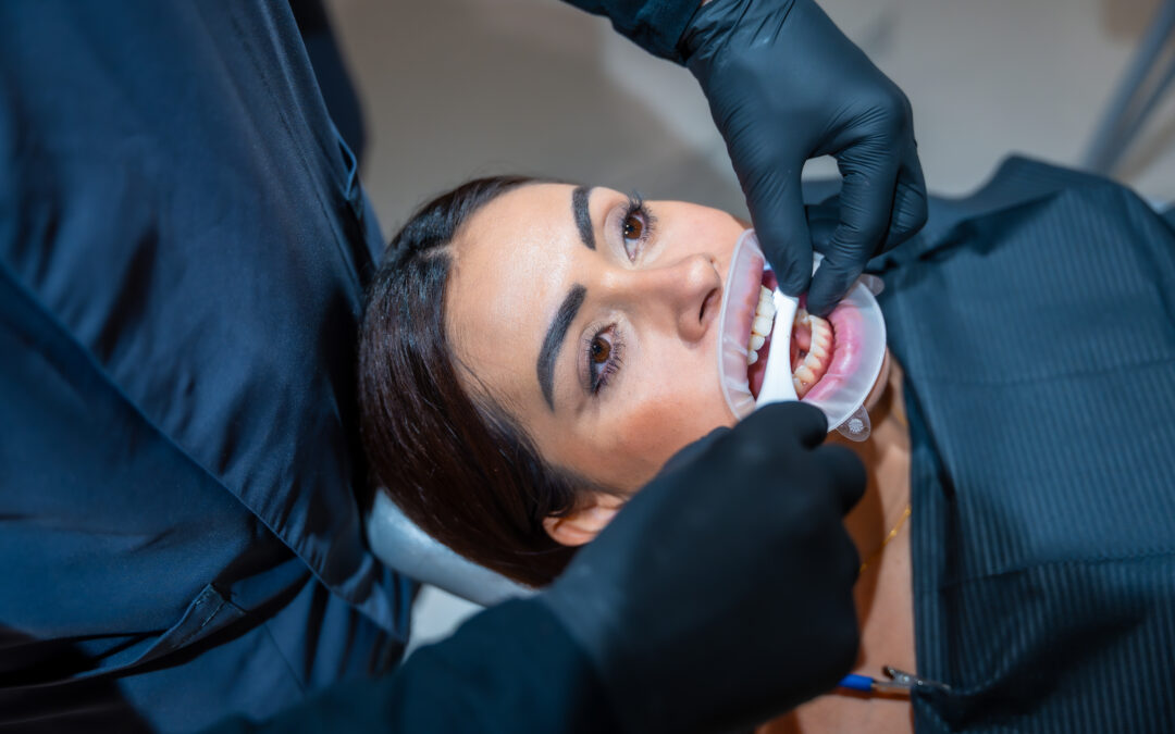 What Are The Most Popular Cosmetic Dental Procedures?