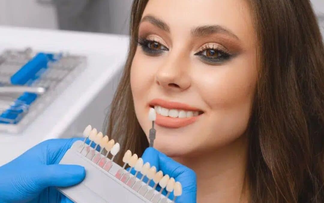 How Dental Veneers Can Correct Imperfections in Your Smile?