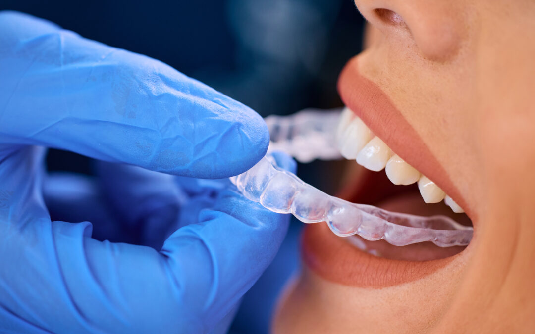 Why Is Invisalign the Preferred Choice for Teens and Adults?