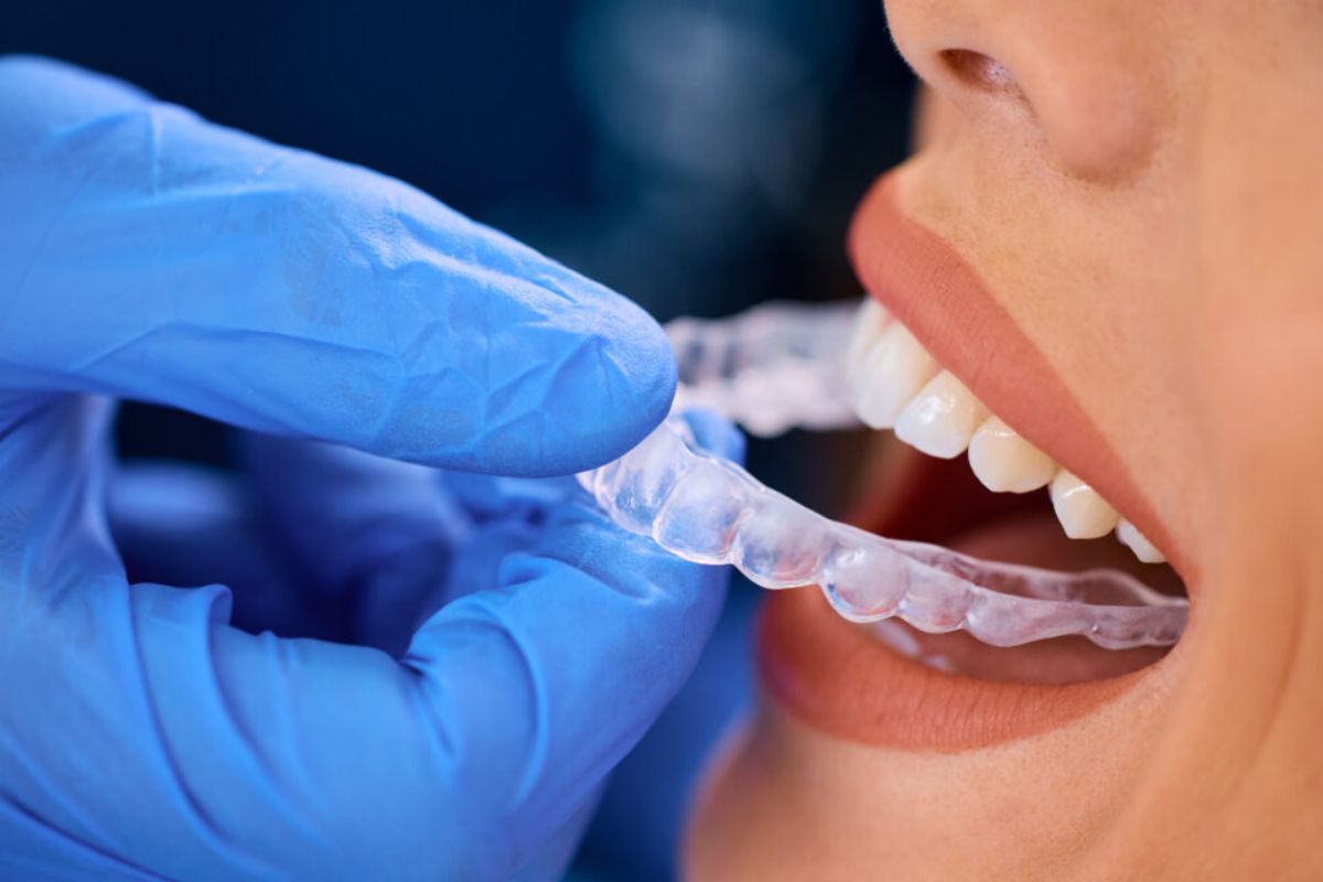 Invisalign treatment