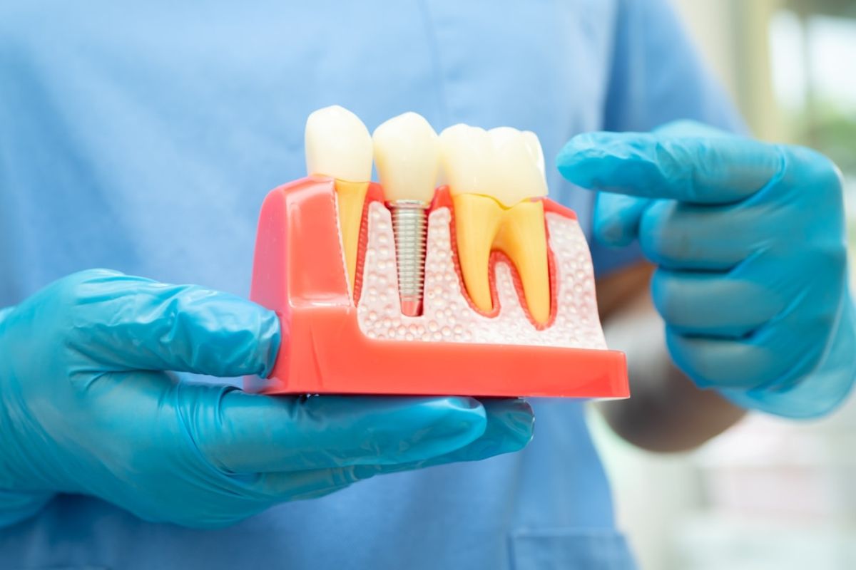 Dental Implants Tulsa