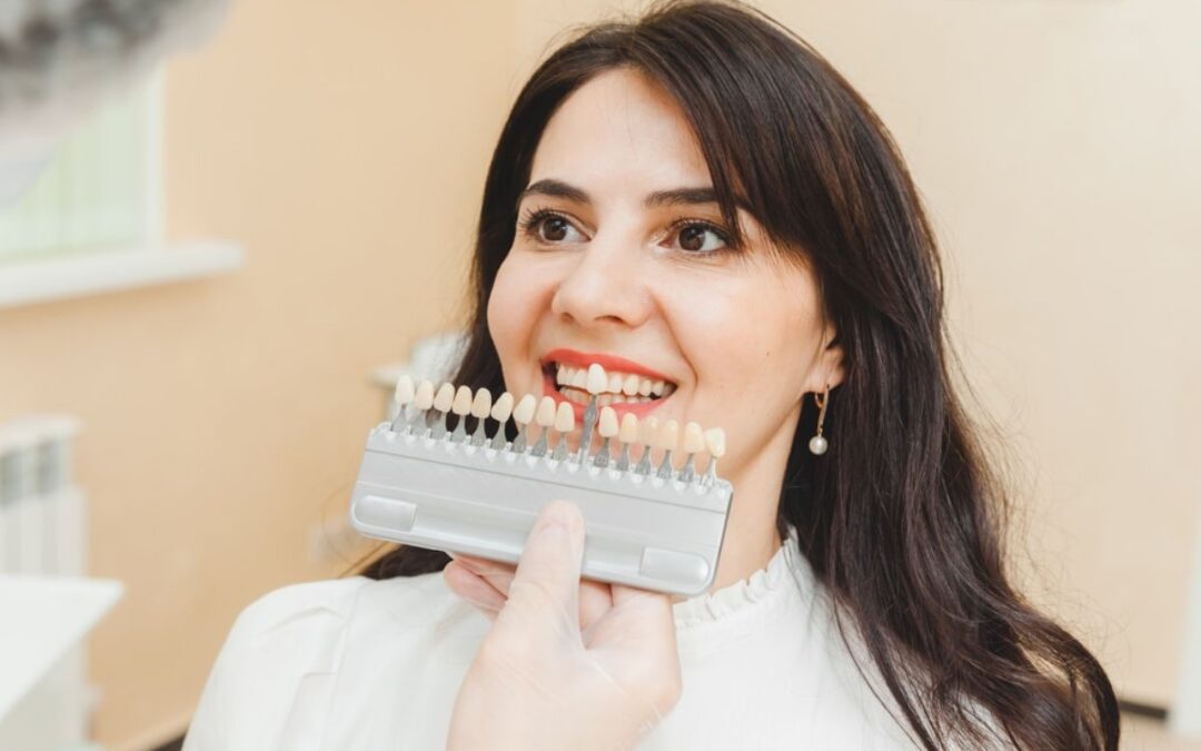 What To Expect After A Full Mouth Veneer Procedure?
