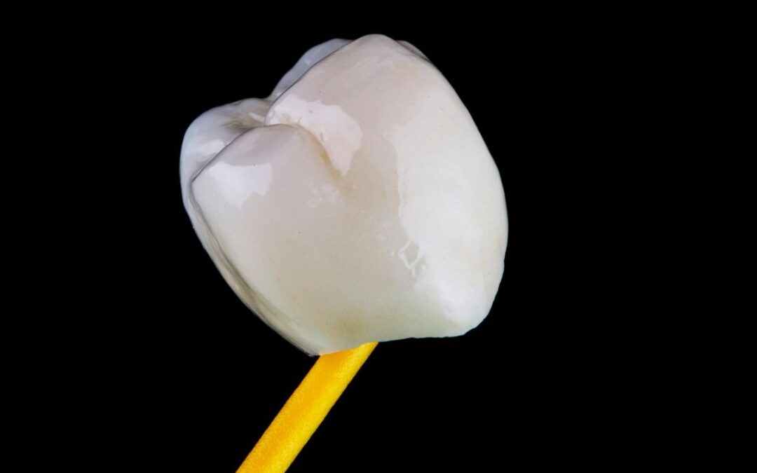 What Should You Do If Your Dental Crown Breaks?