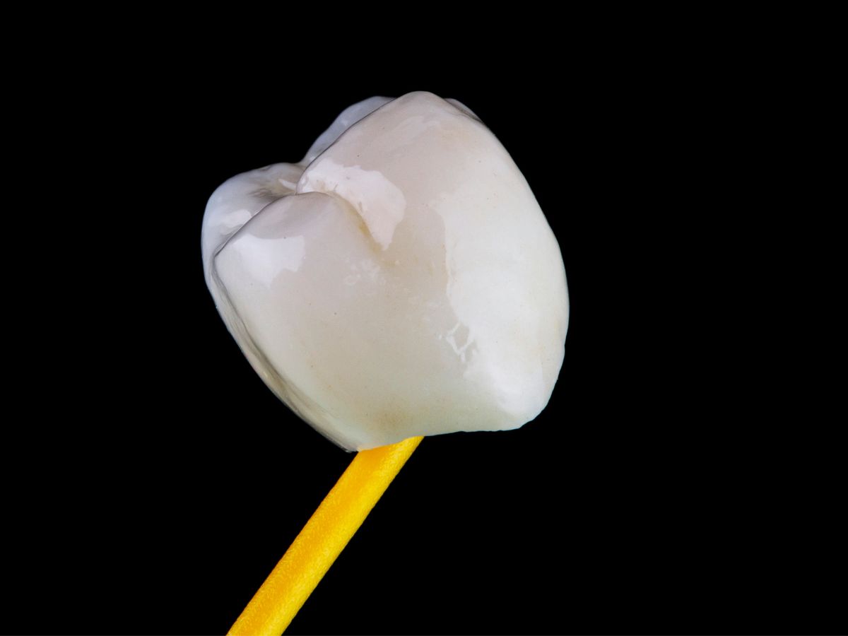dental crown