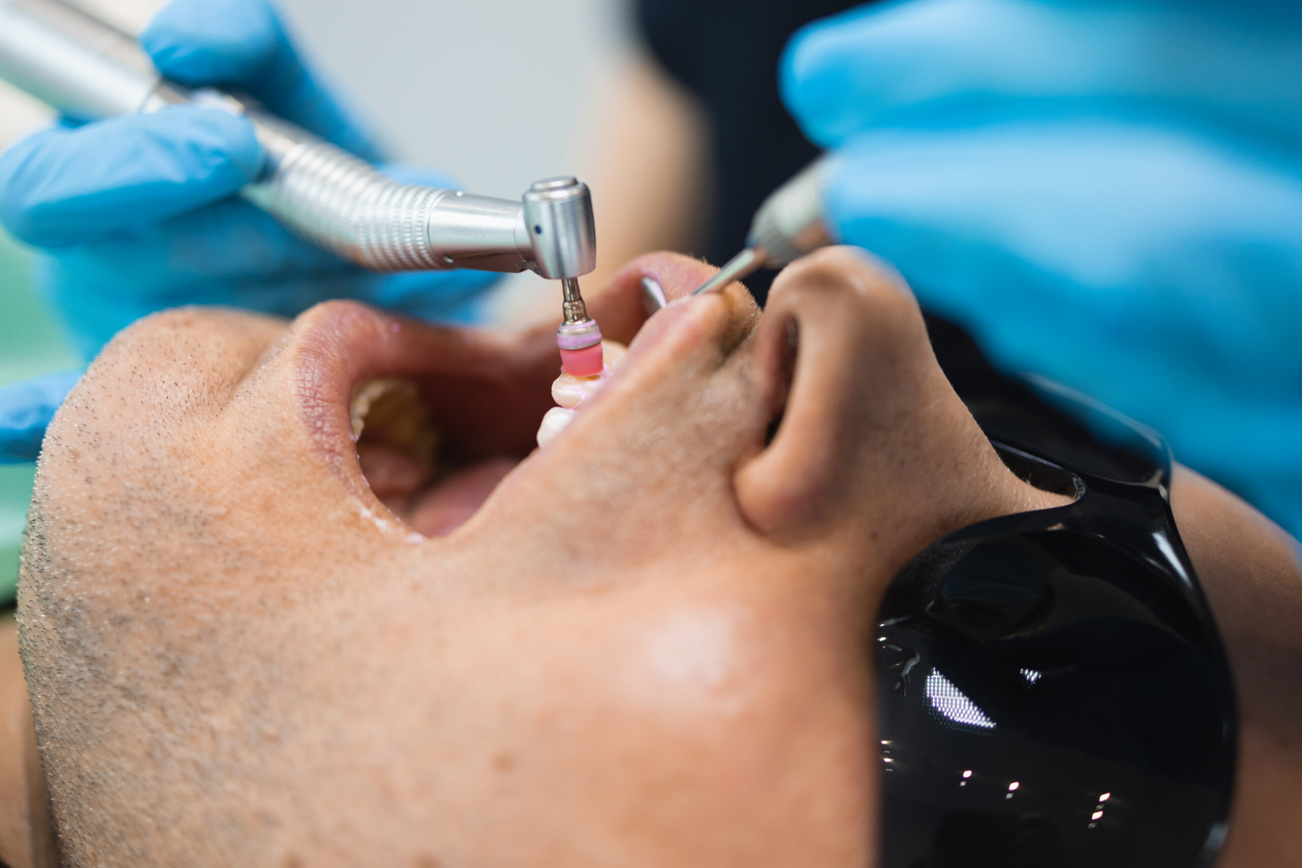 Dentist doing teeth cleaning procedure teeth cleaning
