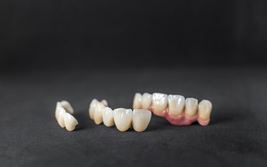 Are Dental Crowns Stronger Than Natural Teeth?