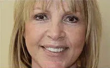 Middle-aged woman smiling confidently after receiving dental veneers, with bright, even, and natural-looking teeth