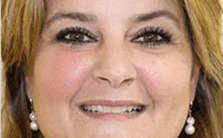 Before dental veneers treatment – woman smiling with braces and uneven teeth