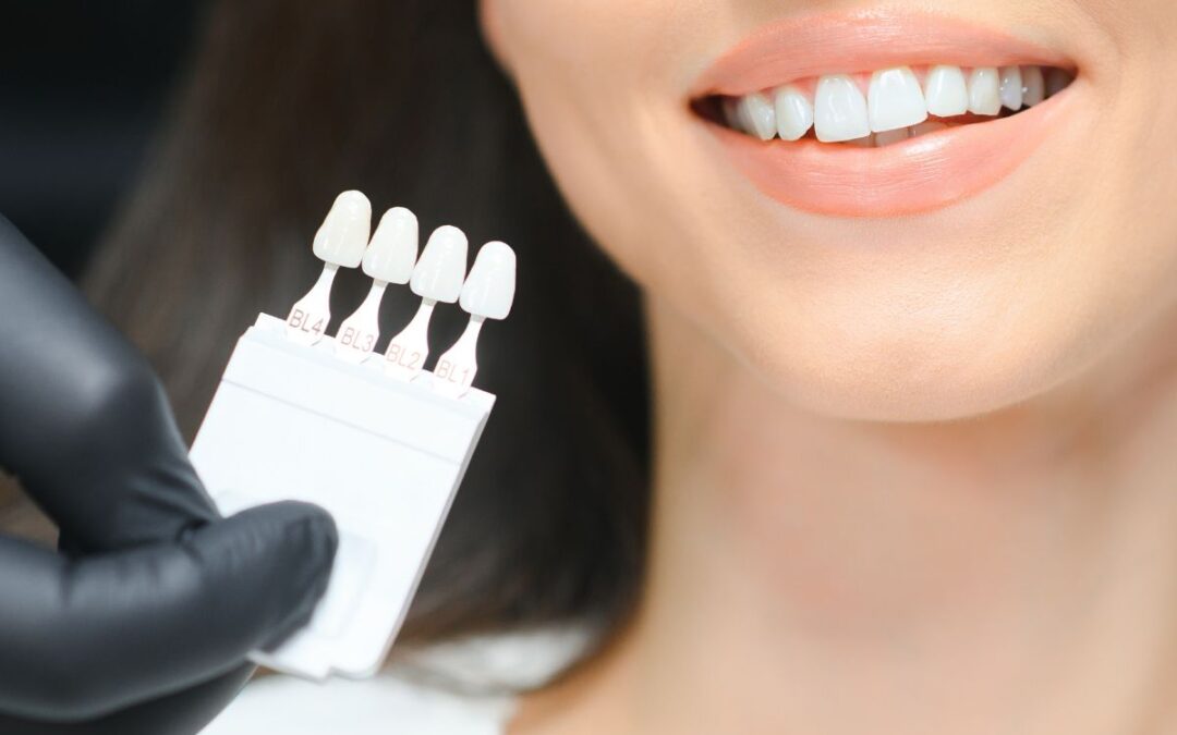 Signs You Need New Veneers – Insights from a Trusted Tulsa Dentist