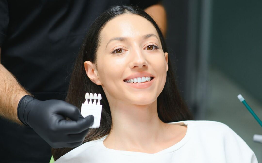 Do Veneers Get Stained and Can They Be Whitened?