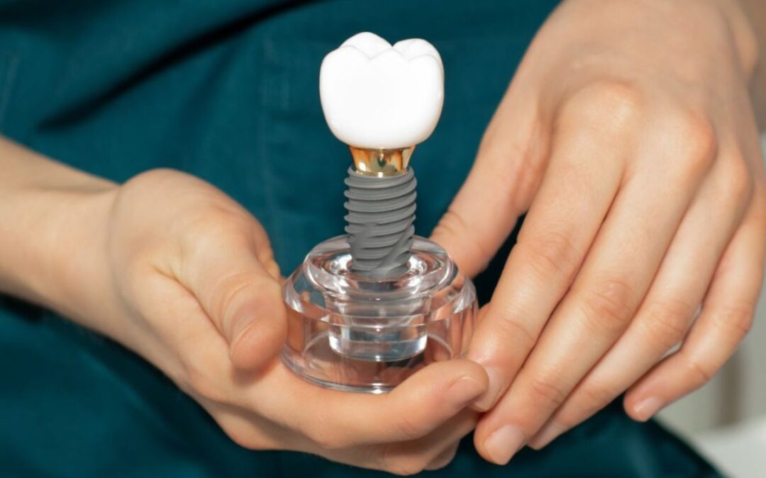 When Is the Right Time for Dental Implants After Tooth Loss?