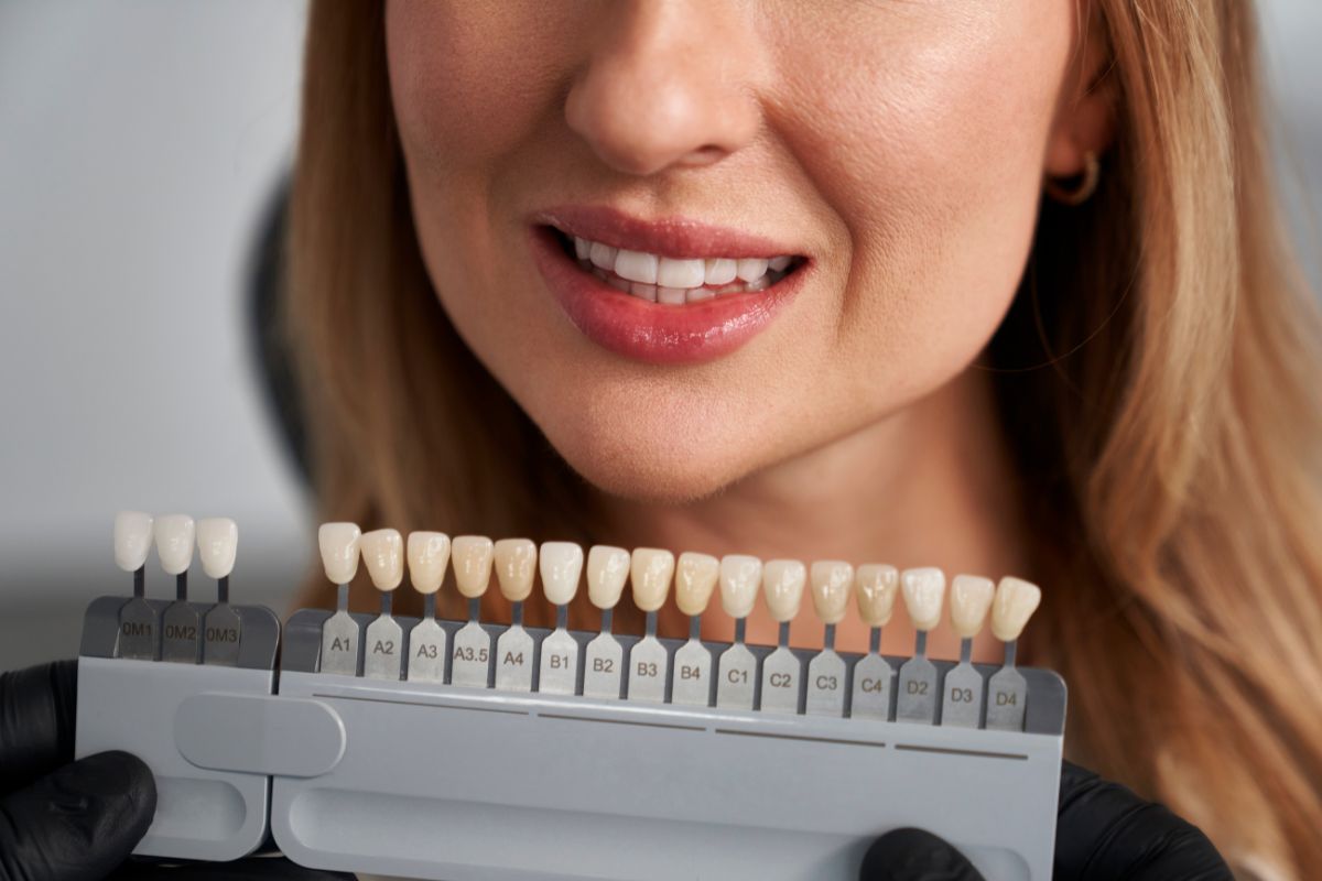 dental veneers treatment
