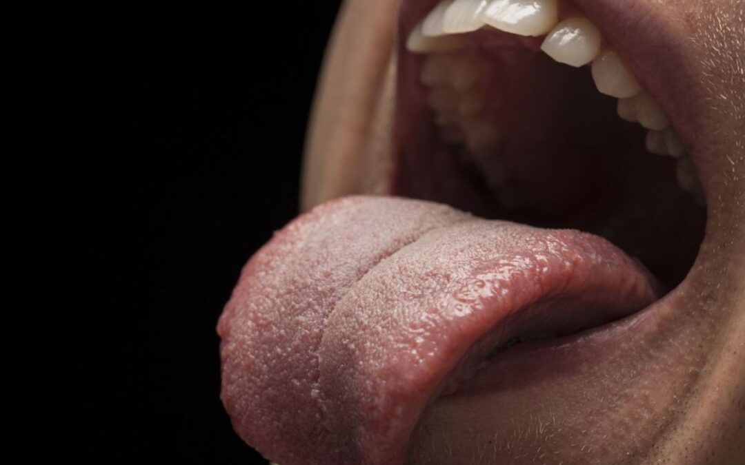 Burnt Your Taste Buds? Do You Really Need To Consult a Dentist