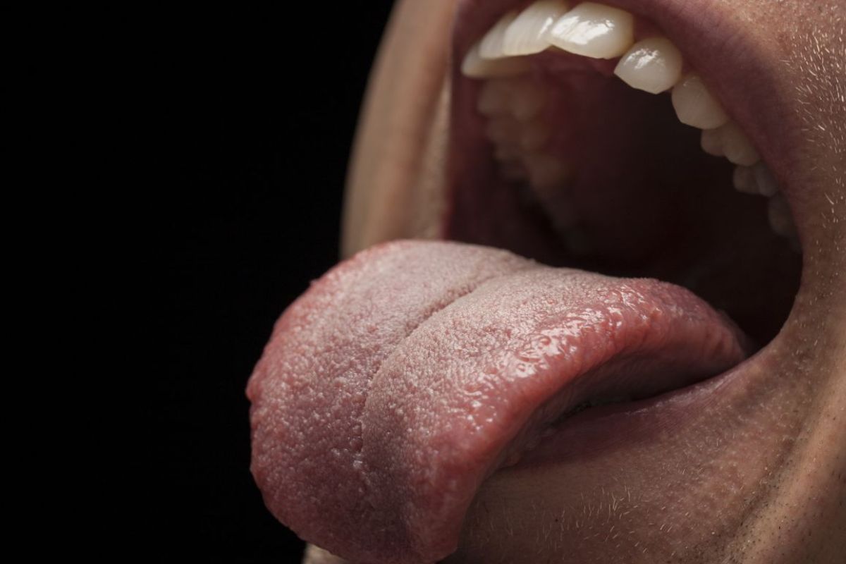 Dentist for Burned Taste Buds