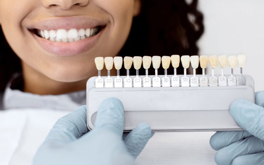 Can Veneers Fix Uneven Teeth Without Braces? What to Know